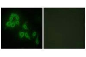 Immunofluorescence analysis of HepG2 cells, using Collagen V α2 antibody. (COL5A2 anticorps)