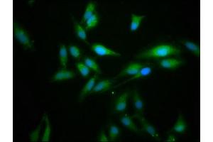 Immunofluorescence staining of Hela cells with ABIN7165598 at 1:166, counter-stained with DAPI. (FLII anticorps  (AA 577-729))