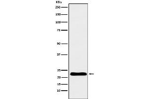 Western blot analysis of TNNI1 expression in Human fetal heart lysate.