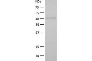 Western Blotting (WB) image for Transcriptional Adaptor 3 (TADA3) (AA 1-432) protein (His-IF2DI Tag) (ABIN7125452)
