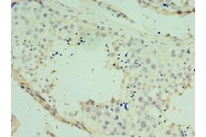 Immunohistochemistry of paraffin-embedded human testis tissue using ABIN7170477 at dilution of 1:100 (SPAG16 anticorps  (AA 1-183))
