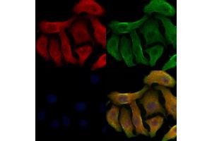 ABIN6263787 and ABIN6278498 staining Hela cells by IF/ICC.