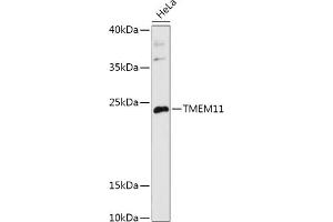 Western blot analysis of extracts of HeLa cells, using TMEM11 antibody (ABIN7270952) at 1:1000 dilution. (TMEM11 anticorps  (AA 1-80))