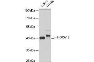 Western blot analysis of extracts of various cell lines, using HOX antibody (999) at 1:1000 dilution.