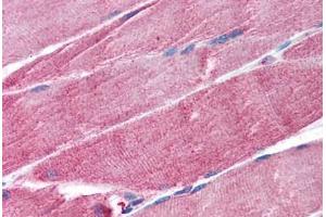 Human Skeletal Muscle (formalin-fixed, paraffin-embedded) stained with TRIM63 antibody ABIN297307 at 1. (TRIM63 anticorps  (AA 247-261))