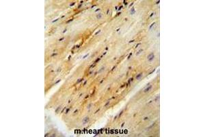 GPD1L antibody (N-term) immunohistochemistry analysis in formalin fixed and paraffin embedded mouse heart tissue followed by peroxidase conjugation of the secondary antibody and DAB staining. (GPD1L anticorps  (N-Term))