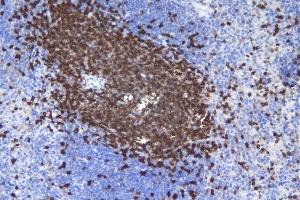IHC analysis of CD5 using anti-CD5 antibody (ABIN7600839). (CD5 anticorps  (AA 24-494))