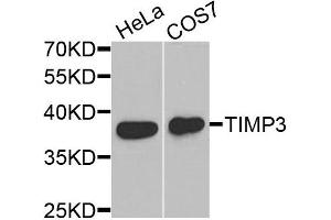 Western blot analysis of extracts of HeLa and COS7 cells, using TIMP3 antibody. (TIMP3 anticorps)