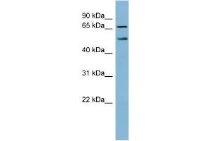 WB Suggested Anti-MYST1 Antibody Titration:  0. (MYST1 anticorps  (N-Term))