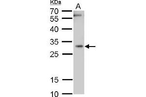 WB Image Heme Oxygenase 1 antibody detects Heme Oxygenase 1 protein by western blot analysis. (HMOX1 anticorps)