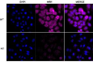 anti-Methylthioribose-1-Phosphate Isomerase 1 (Mri1) antibody