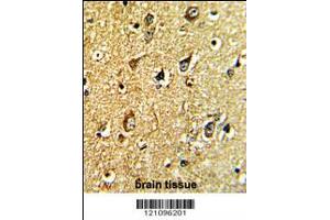 Formalin-fixed and paraffin-embedded human brain tissue with TH Antibody , which was peroxidase-conjugated to the secondary antibody, followed by DAB staining. (TH anticorps  (C-Term))