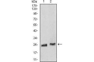 Western Blotting (WB) image for anti-RAB5A, Member RAS Oncogene Family (RAB5A) (AA 1-215) antibody (ABIN5876083) (RAB5 anticorps  (AA 1-215))