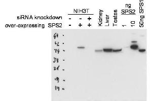 Western blot using  Protein A purified anti-SPS2 antibody shows detection of SPS2 in NIH3T3 cells over-expressing this protein. (SEPHS2 anticorps)