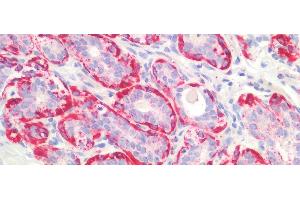 Detection of MYH11 in Human Breast Tissue using Polyclonal Antibody to Myosin Heavy Chain 11, Smooth Muscle (MYH11)