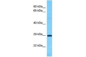 Host:  Rabbit  Target Name:  SLC25A35  Sample Type:  Stomach Tumor lysates  Antibody Dilution:  1. (SLC25A35 anticorps  (Middle Region))