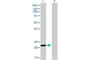 Western Blot analysis of PRDX2 expression in transfected 293T cell line by PRDX2 monoclonal antibody (M01), clone 4E10-2D2. (Peroxiredoxin 2 anticorps  (AA 1-198))