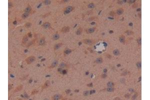 Detection of APC in Mouse Brain Tissue using Polyclonal Antibody to Adenomatosis Polyposis Coli Protein (APC) (APC anticorps  (AA 2636-2845))