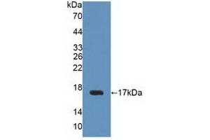 Figure. (Uroplakin 2 anticorps  (AA 26-153))