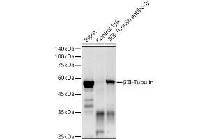 Immunoprecipitation analysis of 300 μg extracts of Mouse brain using 3 μg βIII-Tubulin antibody (ABIN7271049).