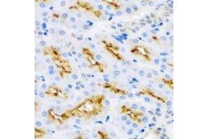 Immunohistochemical analysis of MBP staining in rat kidney formalin fixed paraffin embedded tissue section. (MBP anticorps)