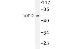 Image no. 1 for anti-Dystrophin Related Protein 2 (DRP2) antibody (ABIN317802) (DRP2 anticorps)