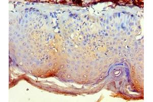 Immunohistochemistry of paraffin-embedded human skin tissue using ABIN7149353 at dilution of 1:100
