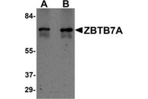 Western blot analysis of ZBTB7A in Human ovary tissue lysate with ZBTB7A / Pokemon antibody at (A) 1 and (B) 2 μg/ml. (ZBTB7A anticorps  (N-Term))