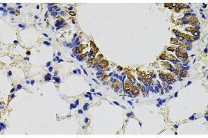 Immunohistochemistry of paraffin-embedded Mouse lung using CD59 Polyclonal Antibody (CD59 anticorps)