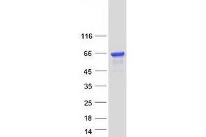 Validation with Western Blot