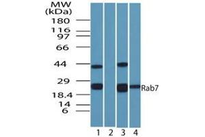 Rab-7 Western Blot. (RAB7A anticorps)
