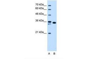 Image no. 1 for anti-Aldo-Keto Reductase Family 1, Member B1 (Aldose Reductase) (AKR1B1) (AA 201-250) antibody (ABIN321393)
