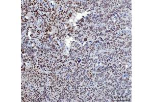 IHC analysis of YY1 using anti-YY1 antibody (ABIN7603000). (YY1 anticorps  (Middle Region))