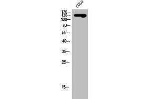 Western Blot analysis of COLO cells using SLC4A8/10 Polyclonal Antibody (SLC4A8/SLC4A1 (Internal Region) anticorps)