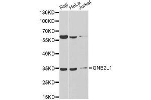 Western blot analysis of extracts of various cell lines, using GNB2L1 antibody.