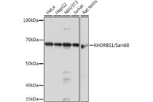 Western blot analysis of extracts of various cell lines, using KHDRBS1/KHDRBS1/Sam68 Rabbit mAb (ABIN1680037, ABIN3018237, ABIN3018238 and ABIN7101585) at 1:1000 dilution.