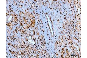 IHC analysis of YY1 using anti-YY1 antibody (ABIN7603000). (YY1 anticorps  (Middle Region))