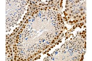 Phospho-SMC1 (Ser966) Antibody at 1/100 staining Mouse testis tissue by IHC-P.