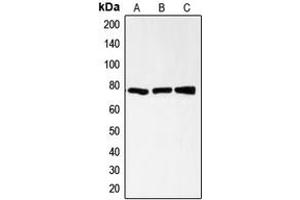 Western blot analysis of CD200R expression in HL60 (A), CCRFCEM (B), AML193 (C) whole cell lysates. (CD200R1 anticorps  (C-Term))