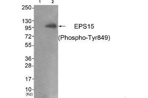 Western blot analysis of extracts from JK cells (Lane 2), using EPS15 (Phospho-Tyr849) Antibody. (EPS15 anticorps  (pTyr849))
