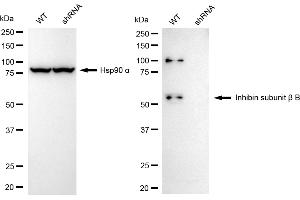 Western blotting analysis using inhibin subunit beta B antibody (ABIN7800941).