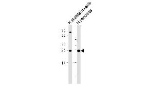 All lanes : Anti-CELA2B Antibody (Center) at 1:2000 dilution Lane 1: human skeletal muscle lysate Lane 2: human pancreas lysate Lysates/proteins at 20 μg per lane. (ELA2B anticorps  (AA 88-122))