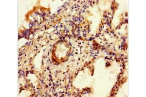 Immunohistochemistry of paraffin-embedded human lung tissue using ABIN7152342 at dilution of 1:100