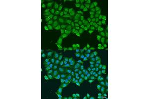 Immunofluorescence analysis of U2OS cells using ATP5O antibody.