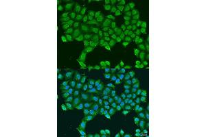 Immunofluorescence analysis of U2OS cells using ATP5O antibody. (ATP5O anticorps  (AA 24-213))