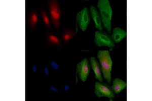 ABIN6264736 and ABIN6279770 staining  cells by IF/ICC. (ARHGAP25 anticorps  (Internal Region))