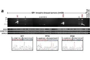 Characterization of the ESR1-CCDC170 fusion in breast cancer cell lines and tissues(a) Representative RT-PCR results of ESR1-CCDC170, wtESR1, and wtCCDC170 in ER+ breast cancer tissues. (CCDC170 anticorps  (C-Term))