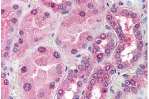 anti-Target of Myb1 (Chicken)-Like 1 (TOM1L1) (C-Term) antibody