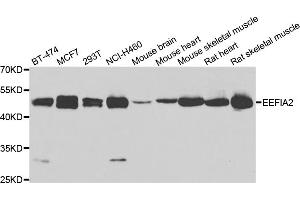 Western blot analysis of extracts of various cell lines, using EEF1A2 antibody (ABIN4903541) at 1:1000 dilution.