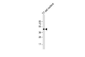 Anti-NKX2-1 Antibody (N-term) at 1:1000 dilution + TT cell nucleus lysate Lysates/proteins at 20 μg per lane.